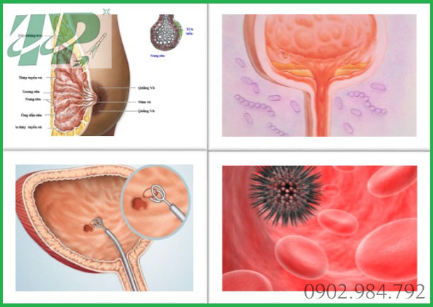 Địa chỉ mua bán bồ công anh tại Hải Phòng